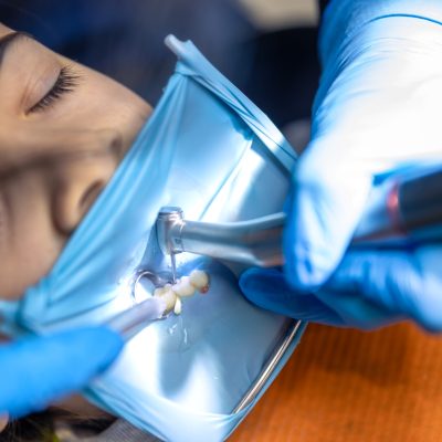Implantes dentários
